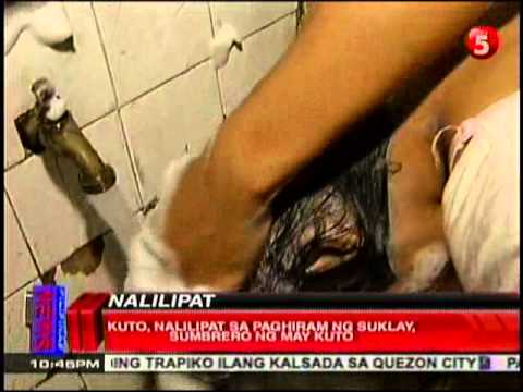 Allergic sa paa halamang-singaw Pasalingsing kuko sa leg treatment sa Samara
