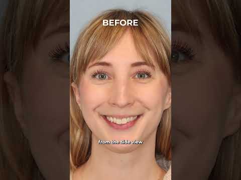 Leong Plastic Surgery NYC