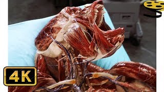Введение радиоактивного протеина Кейн-25 горилле\Introduction of the radioactive protein to gorilla