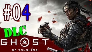 GoT DLC #04 - With the flaming arrow... without mercy!