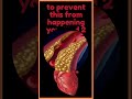 Unbelievably Simple Tip To Reverse Calcification In Your Heart And Arteries