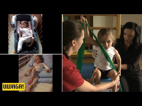 Koślawe kolana deformacji u dzieci jakie buty Equinus deformacja stóp w porażeniem mózgowym