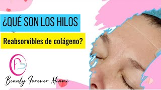 ¿Qué son y para qué sirven los hilos de colágeno reabsorvibles
