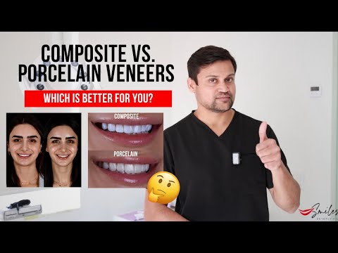 Composite vs. Porcelain Veneers Which is better for you?