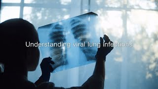 Severe viral lung infections and ARDS, following the science