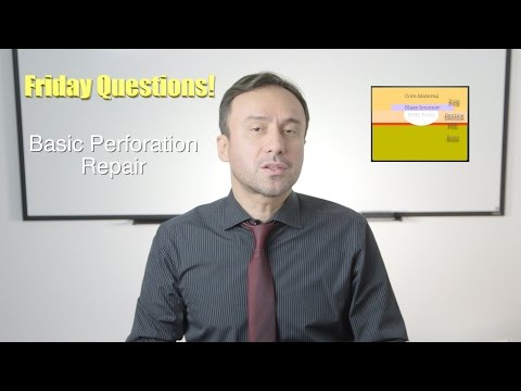 download lagu mp3 mp4 Perforation In Endodontics, download lagu Perforation In Endodontics gratis, unduh video klip Perforation In Endodontics