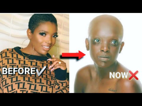 Pray For 2Face Wife Annie Idibia 🙏😭 || True Story Of What Happened to Her and Why?