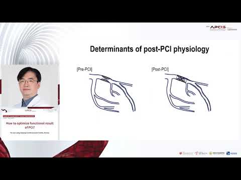 How to optimize functional result of PCI?
