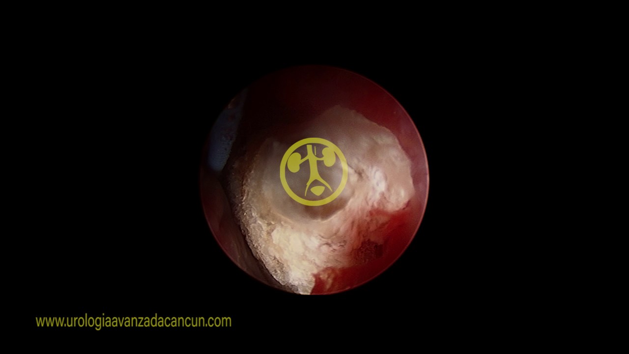 Abraham López Zepeda-12