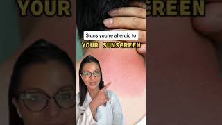 Signs You&#39;re Allergic to Your Sunscreen According to a Dermatologist #shorts