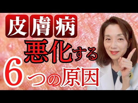 コチニールを完全に除去するにはどうすればよいでしょうか?効果的な6つの自然なヒント!  庭園