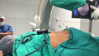 RADIOFRECUENCIA DE RAMO MEDIO LUMBAR (FASCETAS)