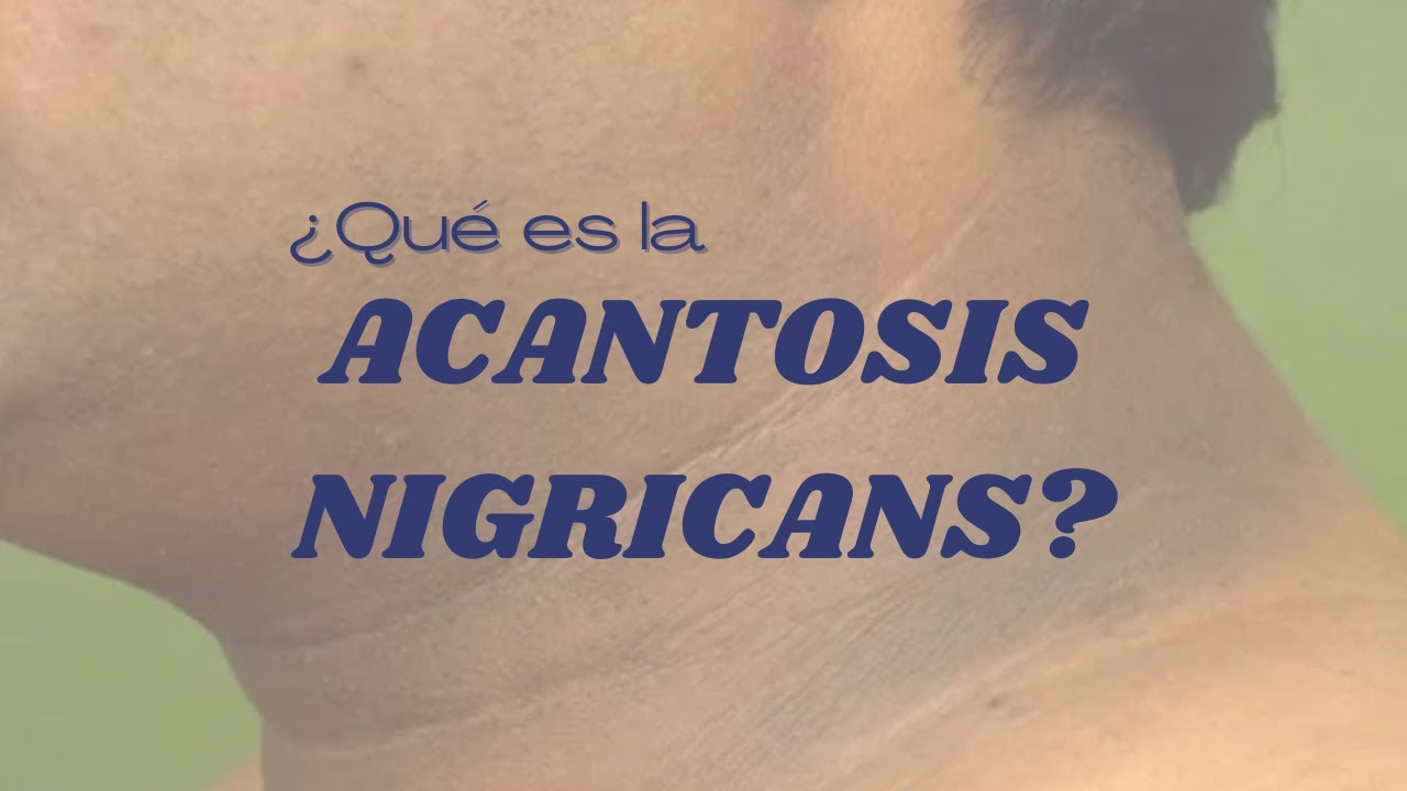 Pedro Esteban Olivares Ariño-8