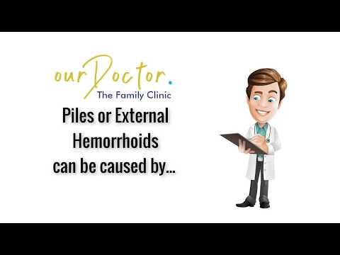 External Piles or Hemorrhoids | ourDoctor | Facts 2019