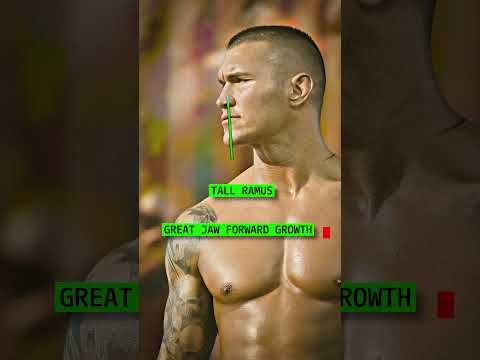 How Attractive is Randy Orton?