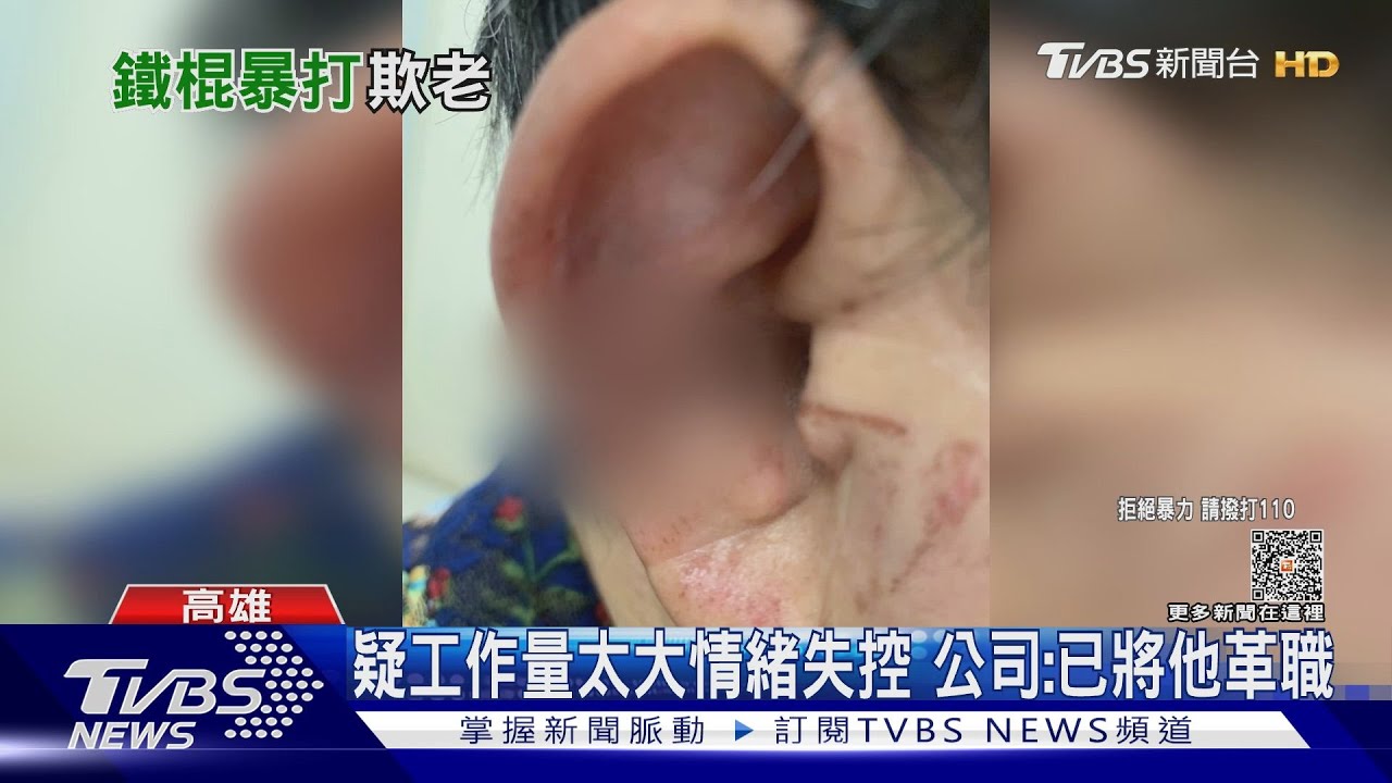 只問一句「帥哥有衛生紙嗎」 婦人遭男清潔員追打濺血