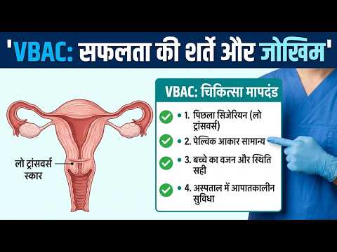 VBAC — video thumbnail