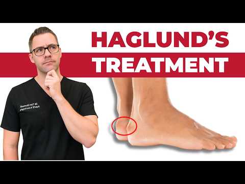 BEST 25 Plantar Fasciitis HOME Treatments Massage Stretches Shoes