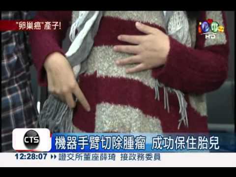 孕婦切除卵巢腫瘤 保住13週胎兒!