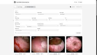 V15-02: CystoWeb, A Longitudinal Cystoscopy Video Database and Platform