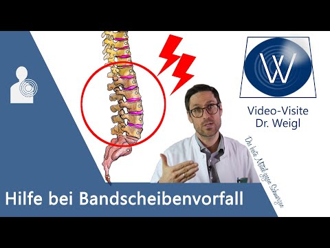 Bandscheibenvorfall (Prolaps) - Diagnose & Therapie (Übungen, Operation) beim Bandscheibenvorfall