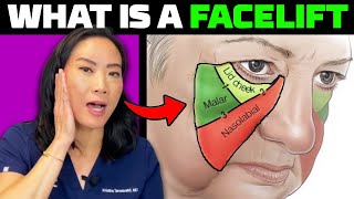 What Is A Deep Plane Facelift?