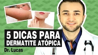 5 Dicas para Dermatite Atópica Alergia em crianças
