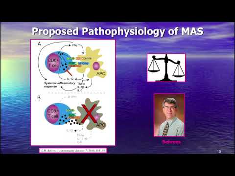 Clinical Trial of Anakinra (Interleukin 1 Receptor Antagonist) in MAS - Randy Cron
