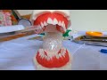 Aplikasi Topikal Flour Dentinstrystudent