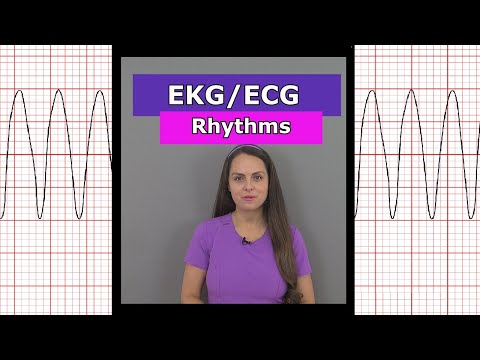 ECG EKG Heart Rhythms Nursing #shorts (afib, vtach, bradycardia, sinus rhythm, aflutter)