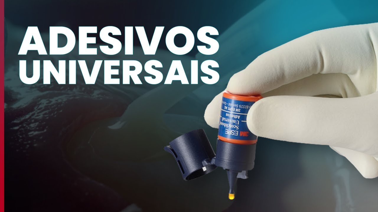 ADESIVOS UNIVERSAIS - Mylene e Renato