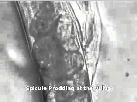 Animal Sex: How Worms Do It