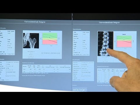 Osteochondrose in Segmenten des c4-c7 Zu dem, was Experten, wenn der wunden Hals zu adressieren