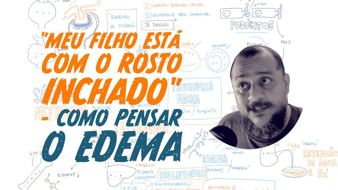 "Meu filho está com o rosto inchado" - Como pensar o edema