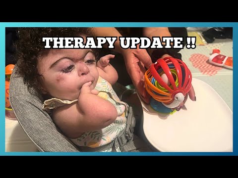 Therapy at Home | Valeria’s Progress & Development Update | CDLS