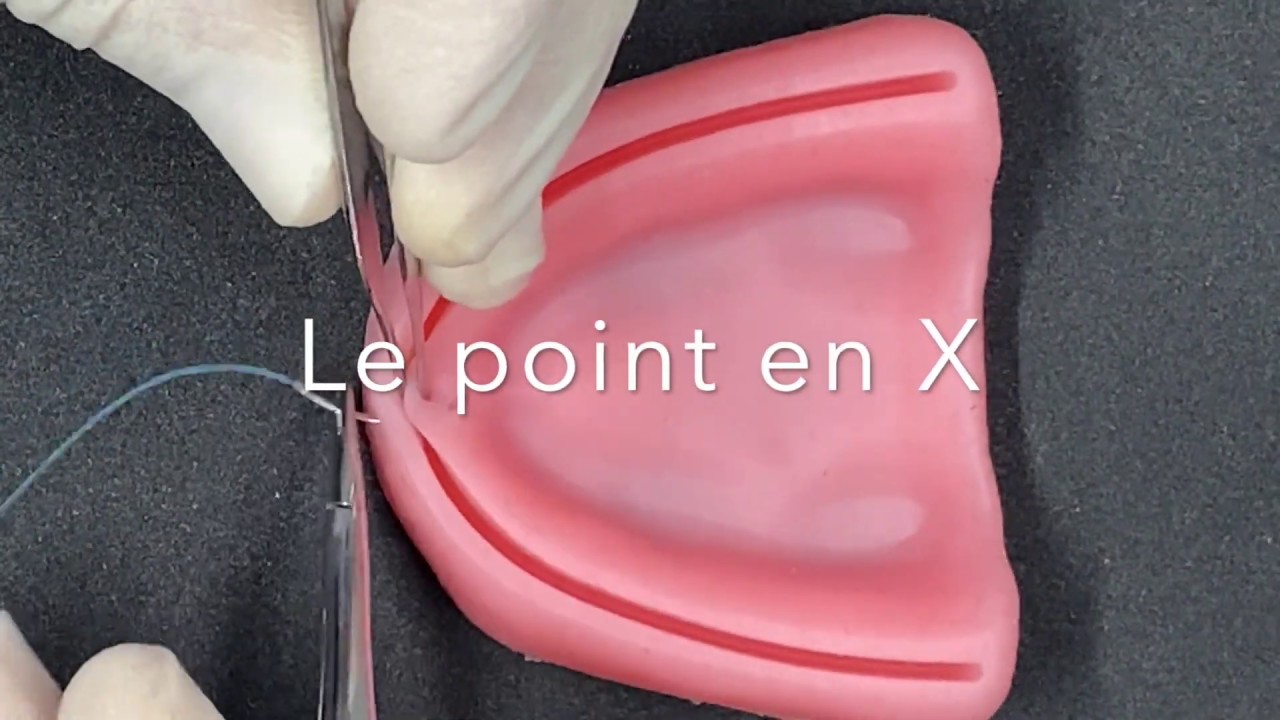 Le point de suture en X