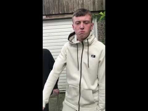 Mc Molegrip Broke His Ankle - (@Itzmefraz)