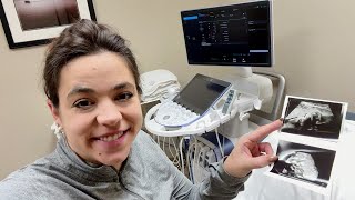 Pregnancy Update 33 Weeks to 35 Weeks with Gestational Diabetes and Room Update!