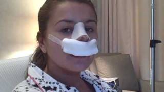 Nose Job VJournal : Day 1
