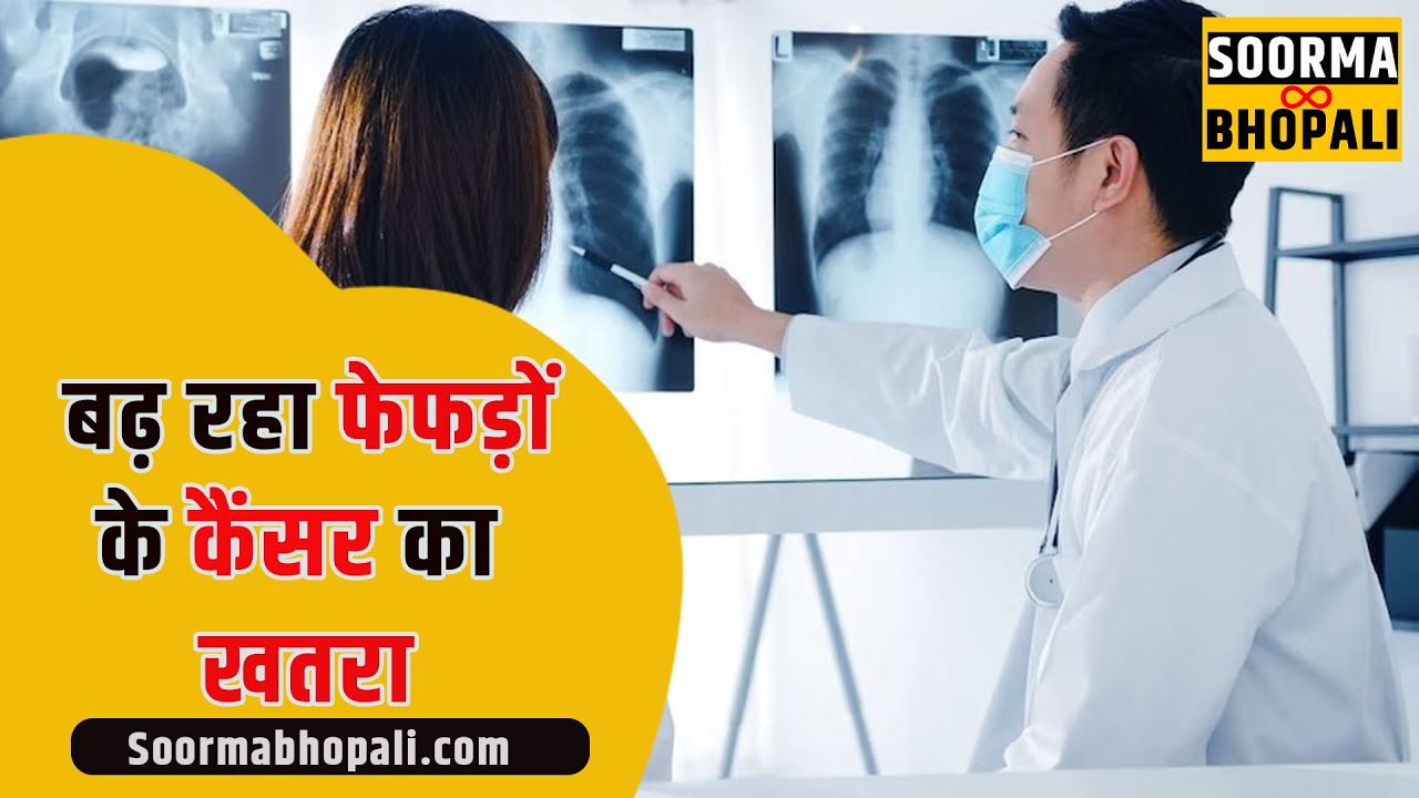 नॉन स्मोकर भी फेफड़ों के कैंसर के खतरे से नहीं बच सकते हैं क्यों ?