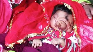 Video: Baby born with an 'elephant trunk' worshiped as Hindu God in India