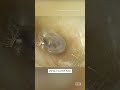 Spider Lives in Woman’s Ear Canal for 4 Days #shorts