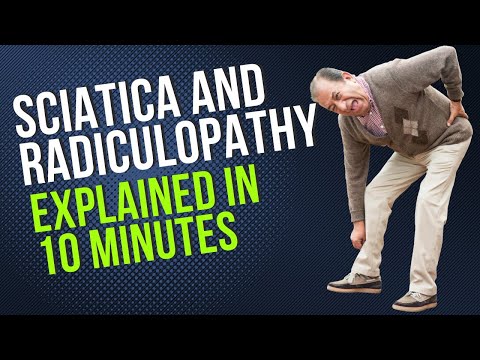 Sciatica & Radiculopathy Explained in 10 Minutes