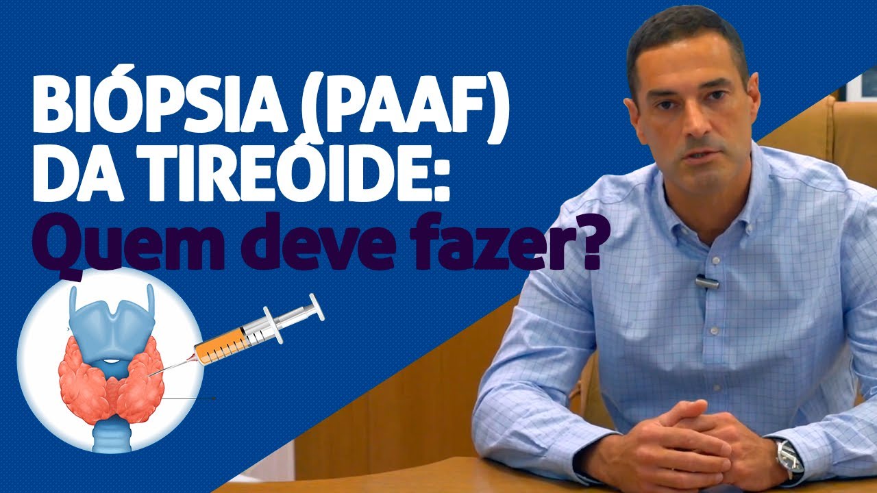 QUAIS NÓDULOS DEVEM FAZER A PAAF (BIÓPSIA) DA TIREÓIDE?