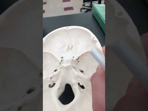 Skull Anatomy - Superior View