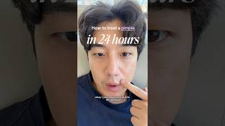 How to Treat a Pimple in 24 Hours 🫧⏱️⏳ #acneproneskin #pimples