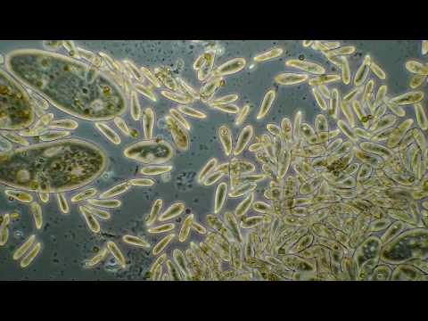 Einzeller aus Heuaufguss  / Pantoffeltierchen