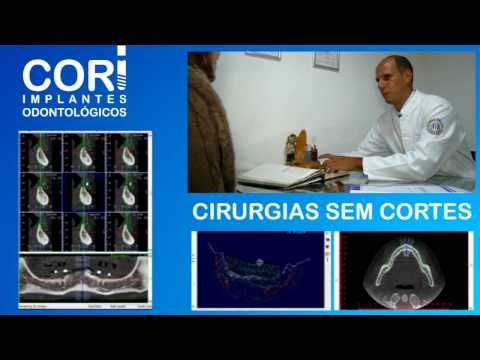 Cori Implantes Odontológicos - ENTmídia / entlei.com