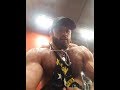 Type 1 Diabetic Bodybuilder and How he Fixed his Edema and Posing after his workout