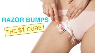 DIY Hack: How to Get Rid of Razor Bumps Fast